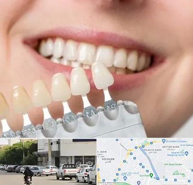 مرکز کامپوزیت دندان در قدوسی شرقی شیراز