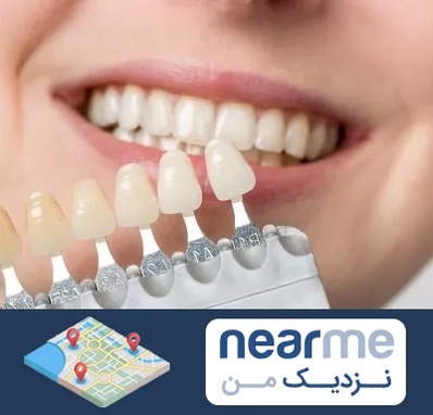مرکز کامپوزیت دندان در نزدیک من
