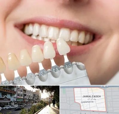 مرکز کامپوزیت دندان در خیابان جمالزاده