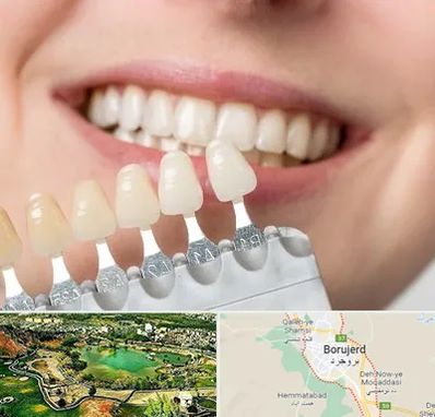 مرکز کامپوزیت دندان در بروجرد