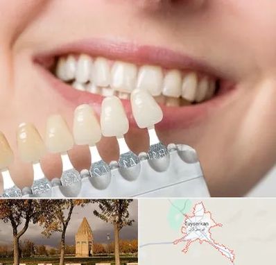 مرکز کامپوزیت دندان در تویسرکان