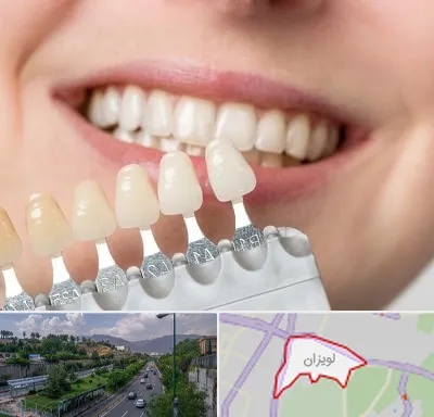 مرکز کامپوزیت دندان در لویزان