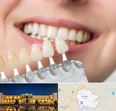 مرکز کامپوزیت دندان در برازجان