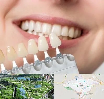 مرکز کامپوزیت دندان در بجنورد