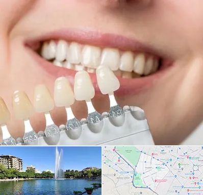 مرکز کامپوزیت دندان در کوهسنگی مشهد