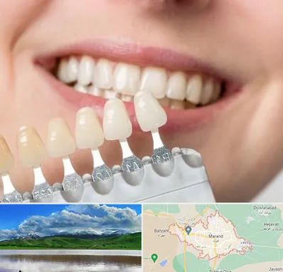 مرکز کامپوزیت دندان در مرند