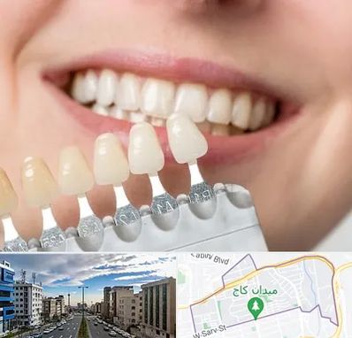 مرکز کامپوزیت دندان در سعادت آباد تهران