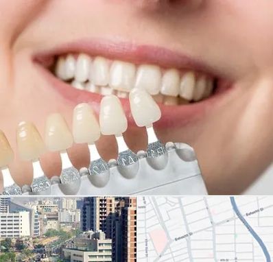 مرکز کامپوزیت دندان در خیابان بهشتی