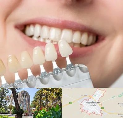 مرکز کامپوزیت دندان در نیشابور