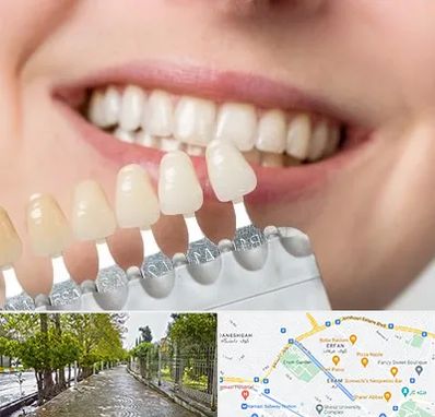 مرکز کامپوزیت دندان در خیابان ارم شیراز