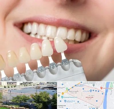 مرکز کامپوزیت دندان در گلستان اهواز