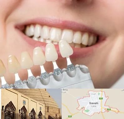 مرکز کامپوزیت دندان در ساوه