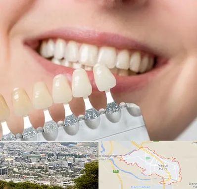 مرکز کامپوزیت دندان در یاسوج