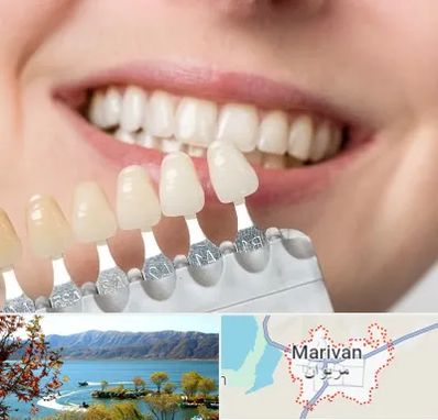 مرکز کامپوزیت دندان در مریوان