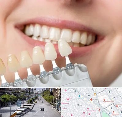 مرکز کامپوزیت دندان در خیابان زند شیراز