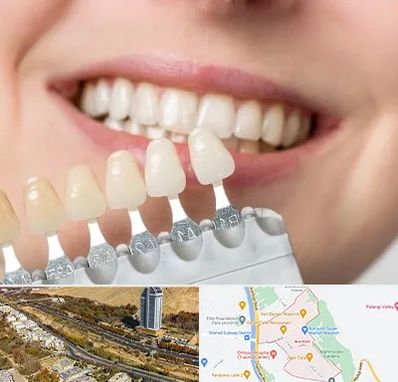 مرکز کامپوزیت دندان در خیابان نیایش شیراز
