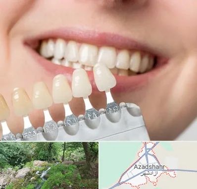 مرکز کامپوزیت دندان در آزادشهر