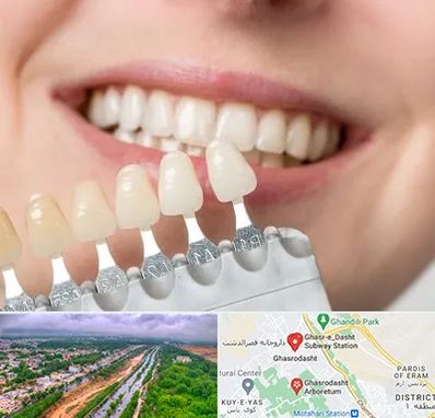 مرکز کامپوزیت دندان در قصرالدشت شیراز