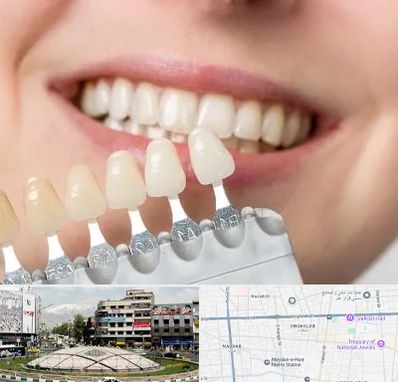 مرکز کامپوزیت دندان در مرکز تهران