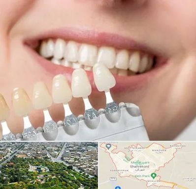 مرکز کامپوزیت دندان در شهرکرد