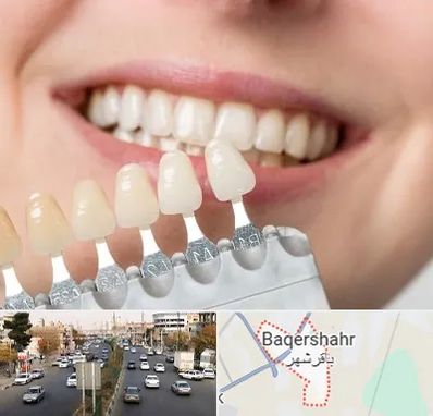 مرکز کامپوزیت دندان در باقرشهر