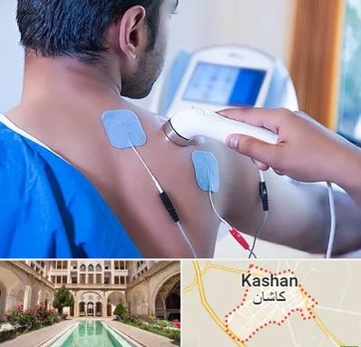 تجهیزات فیزیوتراپی در کاشان