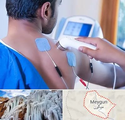 تجهیزات فیزیوتراپی در میگون