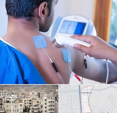 تجهیزات فیزیوتراپی در اسکندری