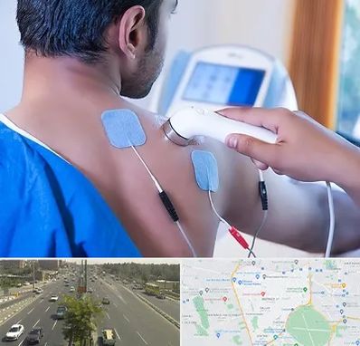 تجهیزات فیزیوتراپی در منطقه 17 تهران 