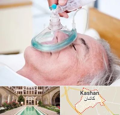 کرایه کپسول اکسیژن در کاشان