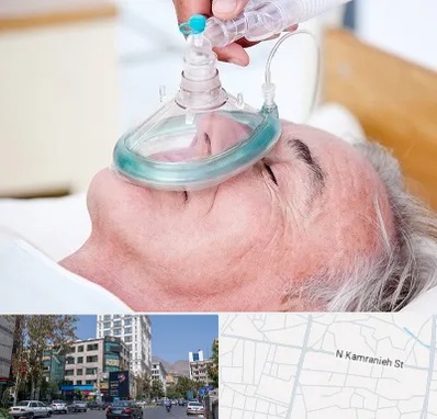 کرایه کپسول اکسیژن در کامرانیه