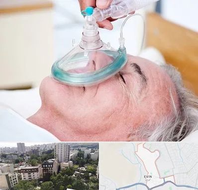 کرایه کپسول اکسیژن در اوین