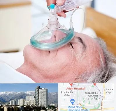 کرایه کپسول اکسیژن در شهرک غرب 