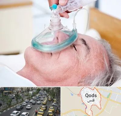 کرایه کپسول اکسیژن در شهر قدس