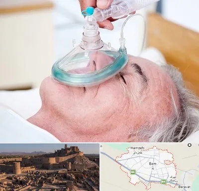 کرایه کپسول اکسیژن در بم