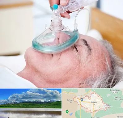 کرایه کپسول اکسیژن در مرند