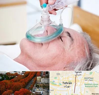 کرایه کپسول اکسیژن در ولیعصر 