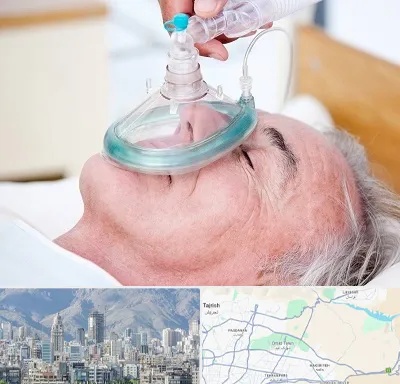 کرایه کپسول اکسیژن در شمال شرق تهران