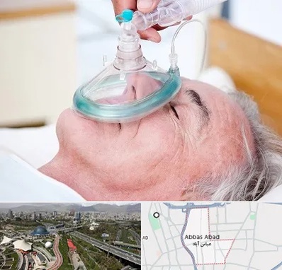 کرایه کپسول اکسیژن در عباس آباد تهران
