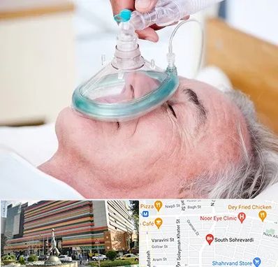 کرایه کپسول اکسیژن در سهروردی 