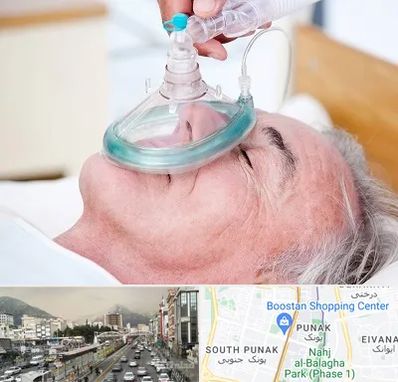 کرایه کپسول اکسیژن در پونک 