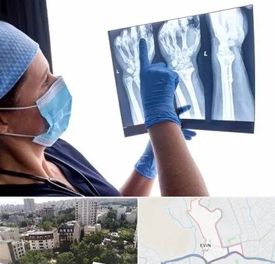 تجهیزات ارتوپدی در اوین