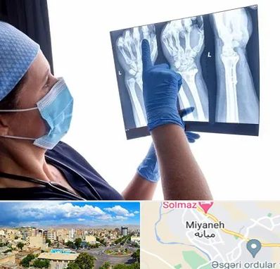 تجهیزات ارتوپدی در میانه