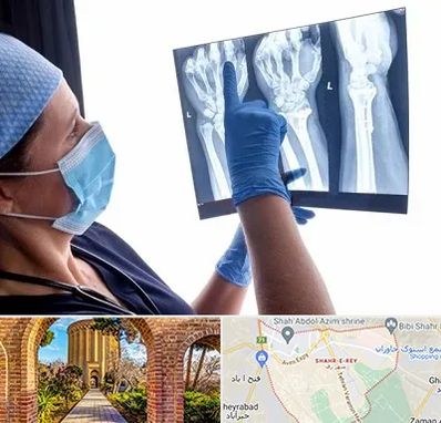 تجهیزات ارتوپدی در شهر ری