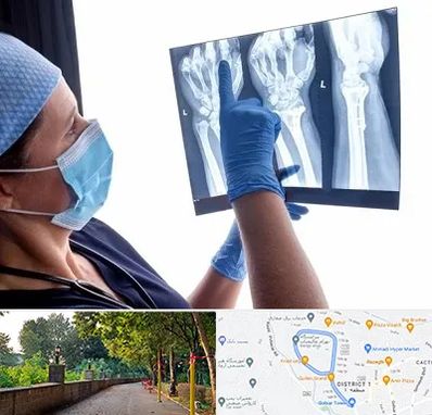 تجهیزات ارتوپدی در فلکه گاز رشت