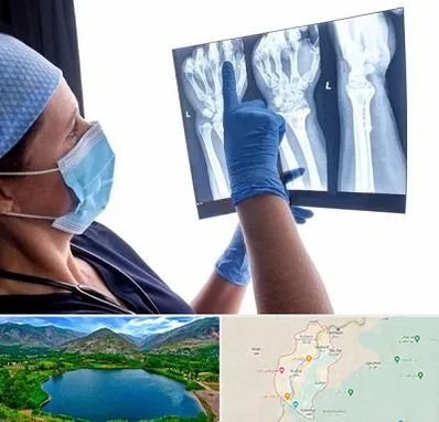 تجهیزات ارتوپدی در رودبار