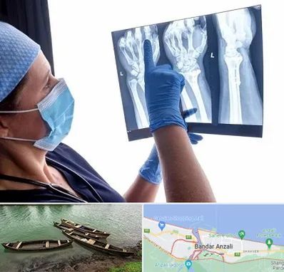 تجهیزات ارتوپدی در بندر انزلی