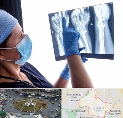 تجهیزات ارتوپدی در فردیس کرج 