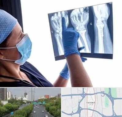 تجهیزات ارتوپدی در توانیر