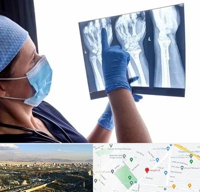 تجهیزات ارتوپدی در هنگام 